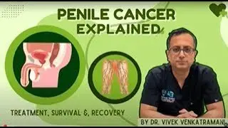 Penile Cancer Explained | Rare but Serious | Dr. Vivek Venkat #PenileCancer