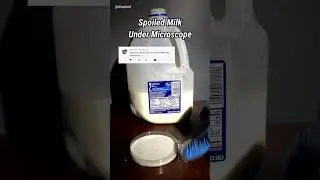 Испорченное молоко под микроскопом (густое и просроченное)
