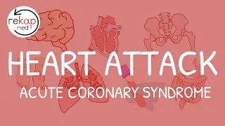 Myocardial Infarction | ACS | (Definition, Symptoms, Investigation, Management) | Rekap Med