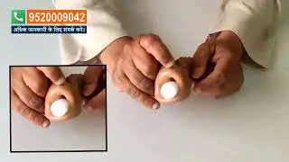 Wonder Condom