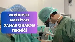 Varikosel Ameliyatı & Damar Çıkarma Tekniği