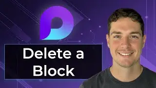 How to Delete a Microsoft Loop Component [2026 Guide]