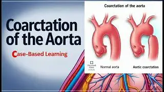 Secondary Hypertension: Coarctation of the Aorta | Clinical Case-Based Learning (ESC 2024)