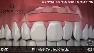 Dr Phelps HD 720p