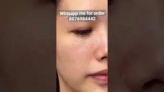 Ice Cream Mask Honest Review | Salicylic Acid Ice Cream Mask