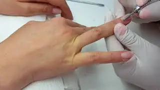 Nagel entfernen 1