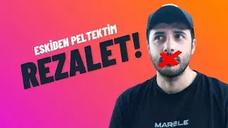Eski Diksiyonum Çok Kötü! (ÖNCESİ-SONRASI)