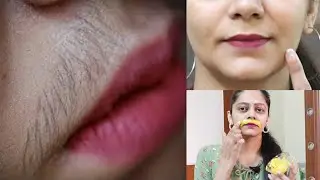 🤷होंठो के उपर के बाल Upper Lips Hair एक बार हटने के बाद वापस कभी नहीं आएंगे | Unwanted Facial Hair