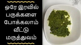 Parukkal poga tips - பருக்களை நீக்குவது எப்படி எளிய வீட்டு வைத்தியம்
