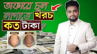 খরচ কমলো হেয়ার ট্রান্সপ্লান্টের এর! Discount Price Hair Transplant Bangladesh Cost