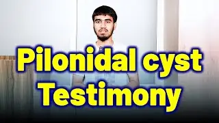 Pilonidal Cyst Sinus Abscess Patient Review Testimony. | Homeopathy, Treatment and Cure