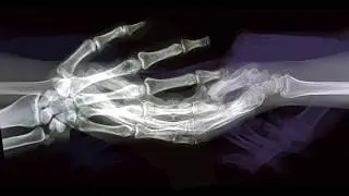 Bone is the Key
