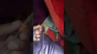 #How to Foley catheter  remove#