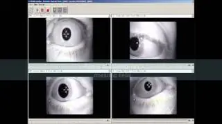Demonstra&ccedil;&atilde;o Video Frenzel