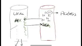 Distal RTA (RTA type 1)