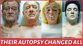 15 Shocking Autopsy Revelations From Golden Age Stars