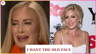 Top 20 Celebrities Who Have Openly Expressed Regret About Cosmetic Surgery | Then and Now 2025