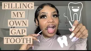 DIY DENTIST | CLOSED THE GAP IN MY TEETH MYSELF | BEAUTY BY PRIMA