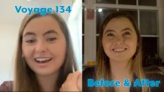 Voyage 134 &ndash; Before & After: Emelie