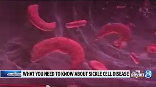 What you need to know about Sickle Cell Disease