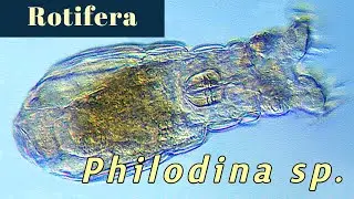 Philodina (Rotifer)