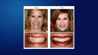 Aventura Dentist on Quality Dentistry