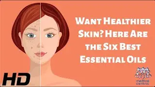 Want Healthier Skin? Here Are The Six Best Essential Oils