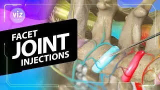 Neck Pain That Won&rsquo;t Quit? This Could Help (3D Animation)