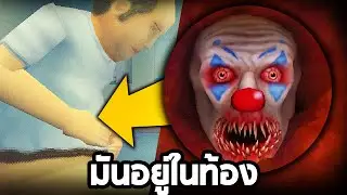ส่องกล้อง เจออะไรอยู่ในท้อง! - Revenge Of The Colon