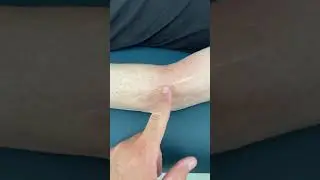 Scar Manipulation