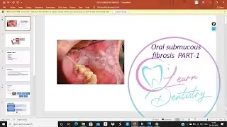 OSF [ORAL SUBMUCOUS FIBROSIS] ORAL PATHOLOGY TOPIC BDS 3rd year BY LEARN DENTISTRY
