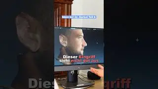 Typ Ver&auml;nderung durch eine kleine Nase | Marc bei Dr.Berkei Teil 6 #drberkei #nase #nasenop