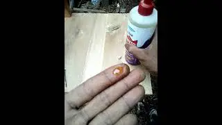 LIHAT BERULANG BIAR PAHAM || JANGAN PANIK KALAU KENA LEM INI