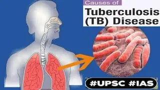 What are various initiatives taken by India to control TB(Tuberculosis)?