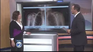 Ask a Specialist: Overuse Injuries in Children