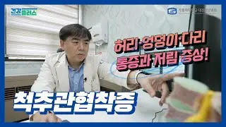 [건강플러스] 허리 아픈데.. 다리까지 저리다!? ‘척추관협착증’┃대전성모병원 정형외과 김영율 교수