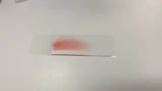 Blood Film Preparation