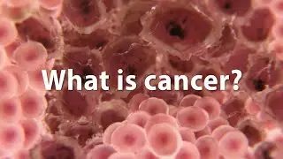 Cancer lesson 5 Q4 MAPEH 7 ( meaning of cancer/ signs/ most common cancer/ treatment)