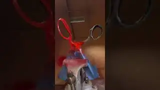 Scissors Restoration for the Impatient