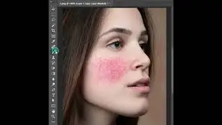 Remove Red Spots On The Skin In Photoshop #shorts
