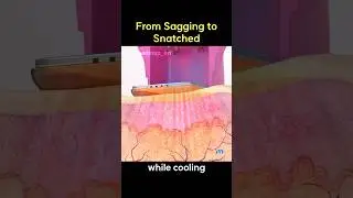 From Sagging to Snatched