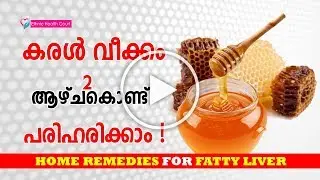 Fatty Liver Symptoms & Fatty Liver Treatment in Malayalam | കരള്&zwj;വീക്കം | Ethnic Health Court