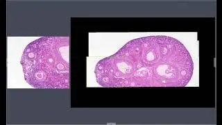 Live Stitching of images, by BioStitch-500 to convert a microscope to a digital sldie scanner