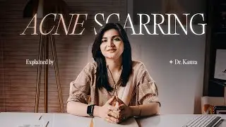 Understanding Acne Scars: Causes, Types & Effective Treatments | Dr. Kanza Aftab