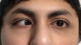 Learning To MOVE ONE EYE