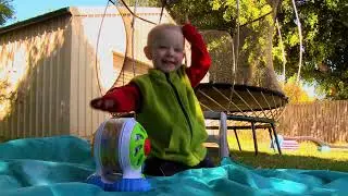 Fragile X Syndrome in Children | Early Signs, Diagnosis & Key Features Explained