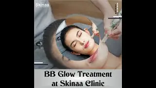 Best BB glow at Skinaa clinic | Viral #shorts