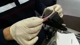 Установка Имплантата MeDent Delta