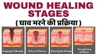 wound healing bsc nursing 3rd semester | stages of wound healing | bsc nursing 3rd semester 2025