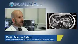 Risonanza magnetica e intelligenza artificiale - Dott. Marco Falchi